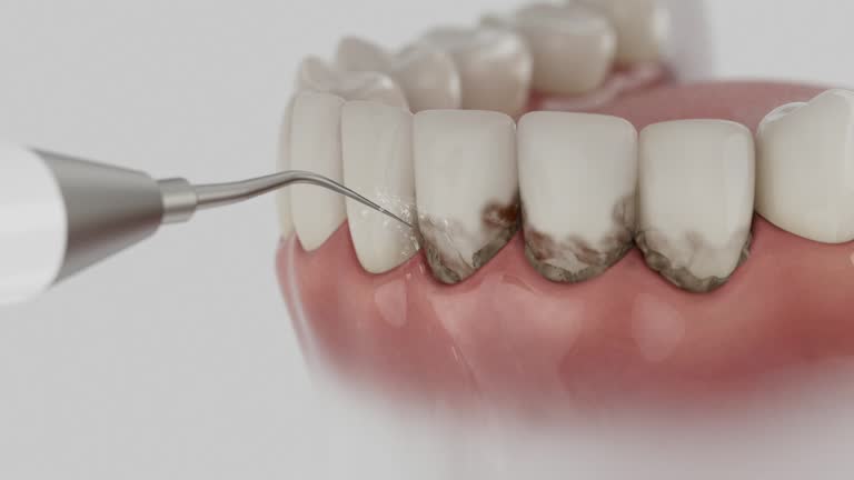 Reliable Dental contractor in Ossun, LA by Smile Center Dentistry
